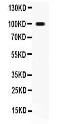 Anti-RANK/TNFRSF11A Antibody Picoband® Boster Bio