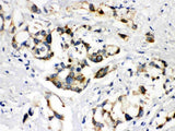 Anti-ABCB11 Antibody Picoband® Boster Bio
