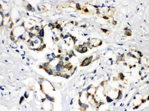 Anti-ABCB11 Antibody Picoband® Boster Bio