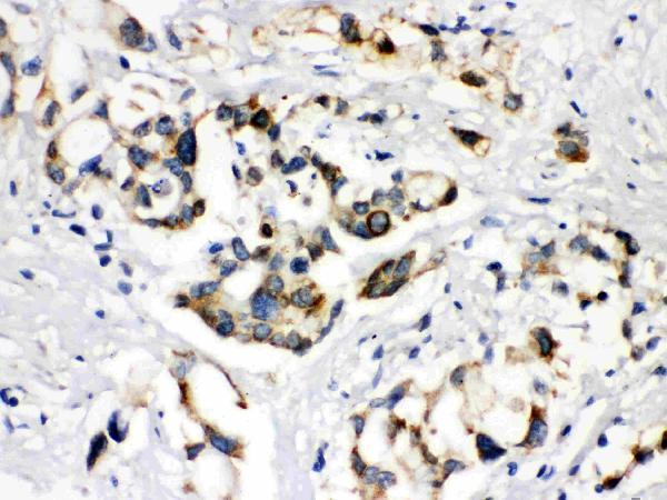 Anti-ABCB11 Antibody Picoband® Boster Bio