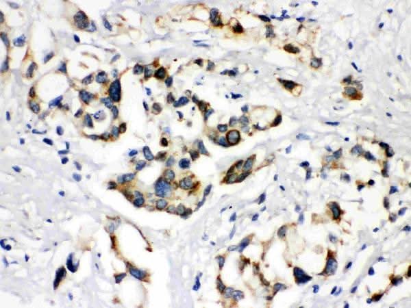Anti-ABCB11 Antibody Picoband® Boster Bio