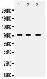 Anti-ABCG5 Antibody Picoband® Boster Bio