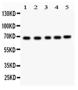 Anti-Acetylcholinesterase/ACHE Antibody Picoband® Boster Bio