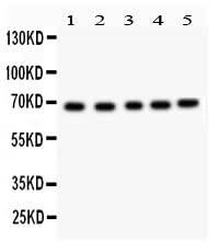 Anti-Acetylcholinesterase/ACHE Antibody Picoband® Boster Bio