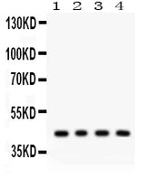 Anti-Adiponectin Receptor 1/ADIPOR1 Antibody Picoband® Boster Bio