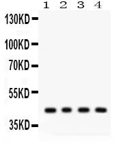 Anti-Adiponectin Receptor 1/ADIPOR1 Antibody Picoband® Boster Bio