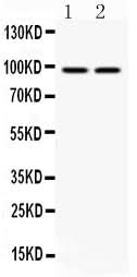 Anti-Aryl hydrocarbon Receptor/AHR Antibody Picoband® Boster Bio