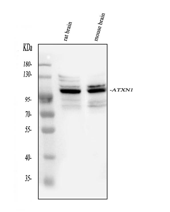 Anti-Ataxin 1/ATXN1 Antibody Picoband® Boster Bio