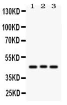 Anti-Ataxin 3/ATXN3 Antibody Picoband® Boster Bio