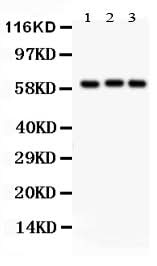 Anti-Heparanase 1/HPSE Antibody Picoband® Boster Bio
