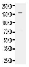Anti-VEGF Receptor 2/KDR Antibody Picoband® Boster Bio