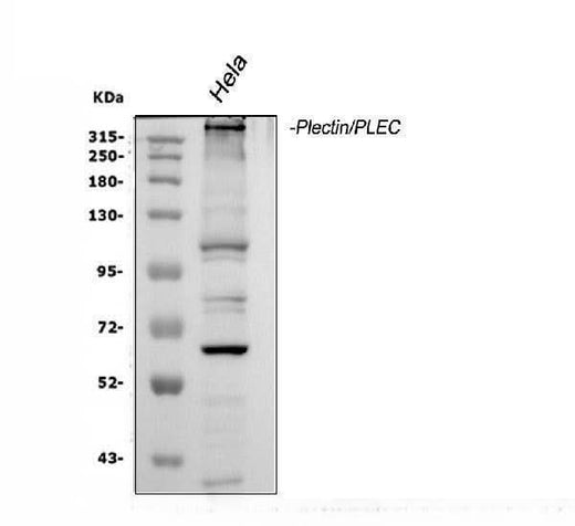 Anti-Plectin Antibody Picoband® Boster Bio