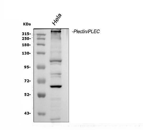 Anti-Plectin Antibody Picoband® Boster Bio