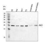 Anti-Rac1 Antibody Picoband® Boster Bio
