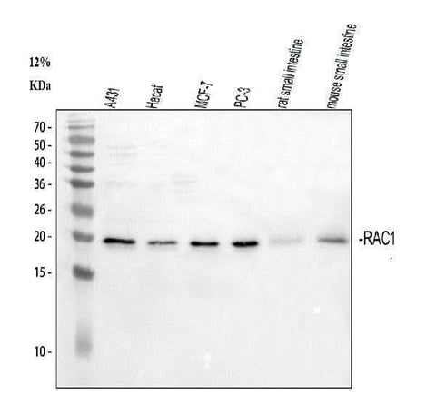 Anti-Rac1 Antibody Picoband® Boster Bio