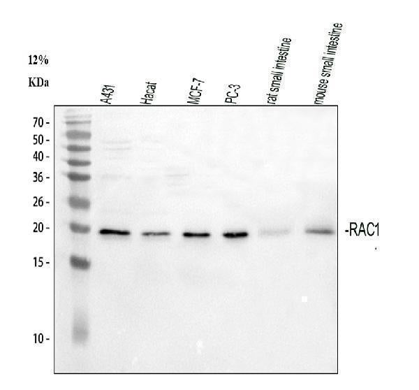 Anti-Rac1 Antibody Picoband® Boster Bio