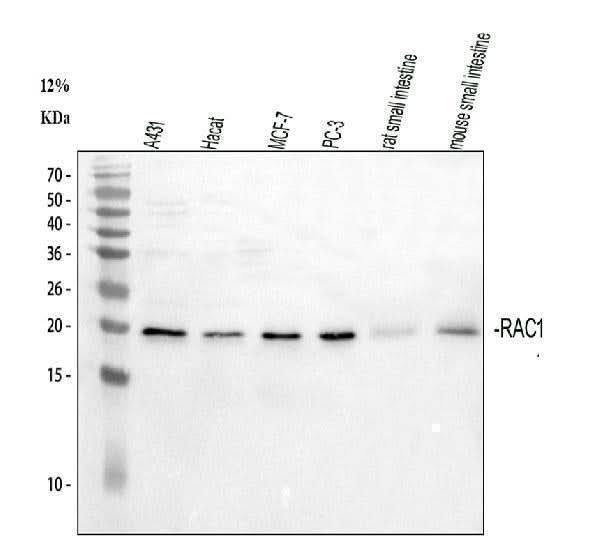 Anti-Rac1 Antibody Picoband® Boster Bio