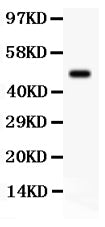 Anti-SGK1 Antibody Picoband® Boster Bio