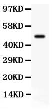 Anti-SGK1 Antibody Picoband® Boster Bio