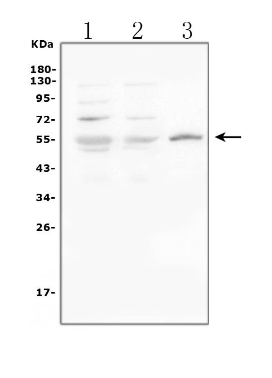 Anti-Glucose Transporter GLUT1/SLC2A1 Antibody Picoband® Boster Bio