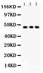 Anti-Glucose Transporter GLUT2/SLC2A2 Antibody Picoband® Boster Bio