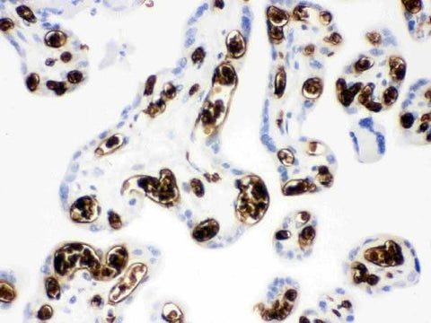 Anti-SLC4A1/CD233/Band 3 Antibody Picoband® Boster Bio
