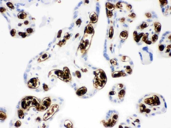 Anti-SLC4A1/CD233/Band 3 Antibody Picoband® Boster Bio