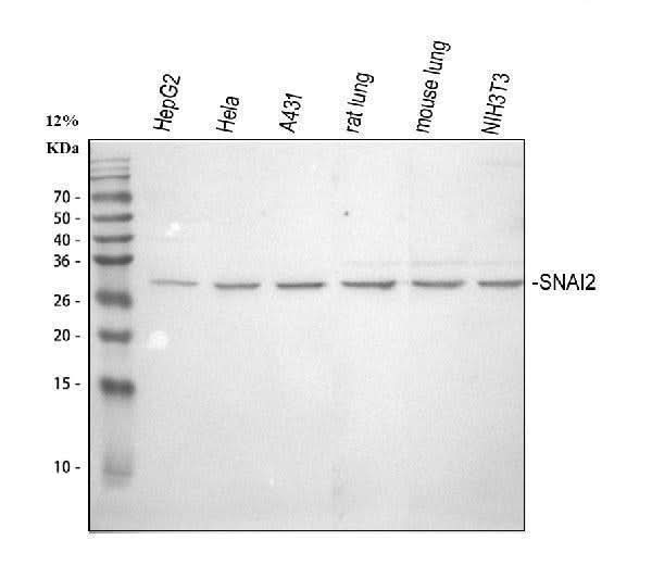 Anti-SLUG/SNAI2 Antibody Picoband® Boster Bio