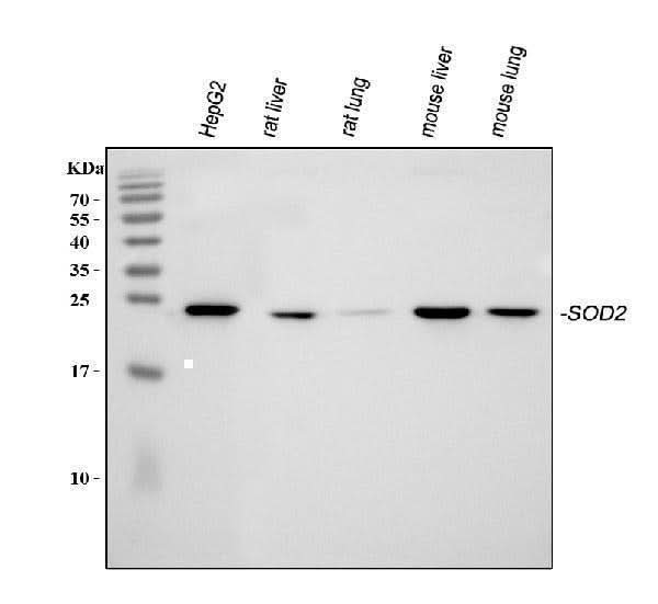 Anti-SOD2 Antibody Picoband® Boster Bio