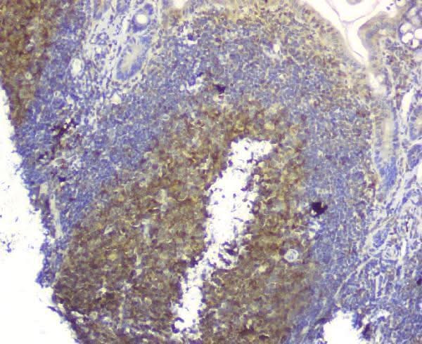 Anti-SQSTM1/p62 Antibody Picoband® Boster Bio