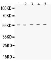 Anti-Neurokinin 1 Receptor/TACR1 Antibody Picoband® Boster Bio