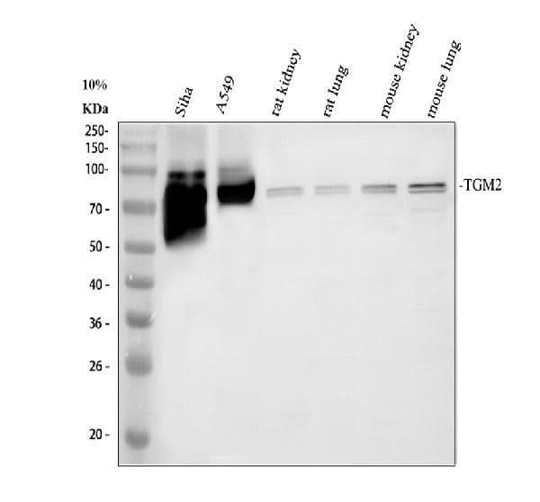 Anti-Transglutaminase 2/TGM2 Antibody Picoband® Boster Bio