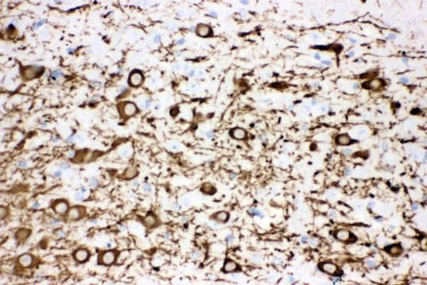 Anti-Tyrosine Hydroxylase/TH Antibody Picoband® Boster Bio