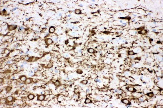 Anti-Tyrosine Hydroxylase/TH Antibody Picoband® Boster Bio