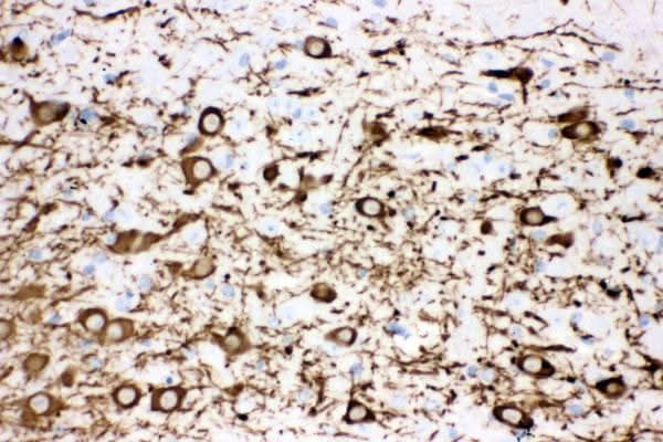Anti-Tyrosine Hydroxylase/TH Antibody Picoband® Boster Bio