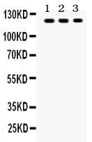 Anti-TLR7 Antibody Picoband® Boster Bio
