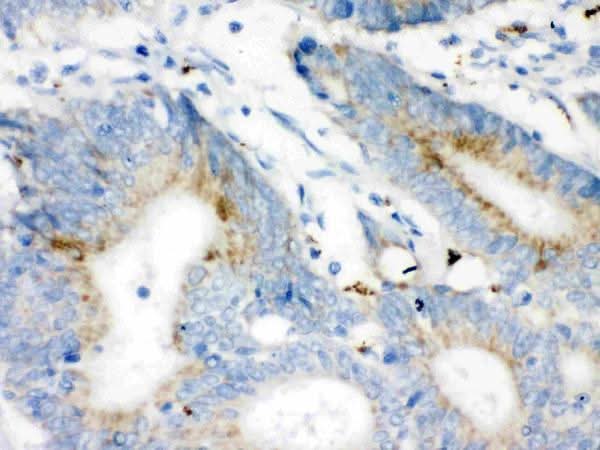 Anti-VDAC/Porin/VDAC1 Antibody Picoband® Boster Bio