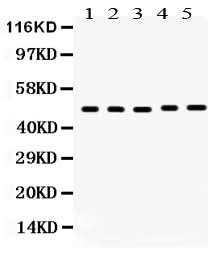 Anti-Vitamin D Receptor/VDR Antibody Picoband® Boster Bio