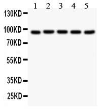 Anti-Villin/VIL1 Antibody Picoband® Boster Bio