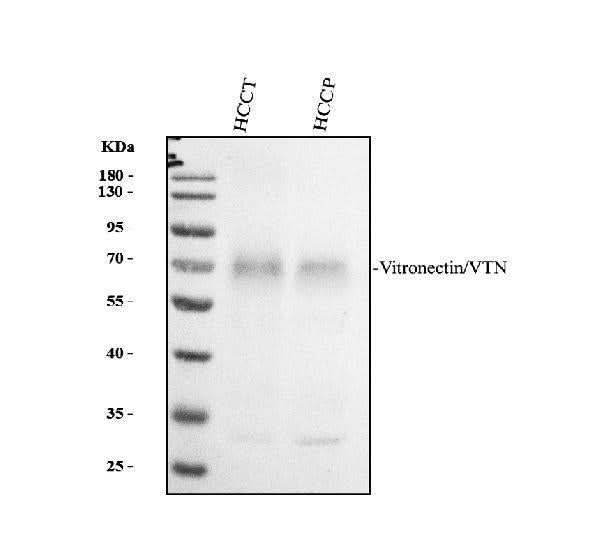 Anti-Vitronectin/VTN Antibody Picoband® Boster Bio