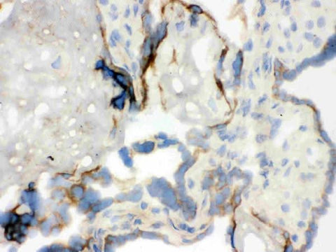 Anti-WASP Antibody Picoband® Boster Bio