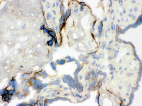 Anti-WASP Antibody Picoband® Boster Bio