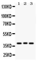 Anti-Wnt2 Antibody Picoband® Boster Bio