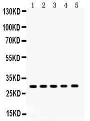 Anti-XBP1 Antibody Picoband® Boster Bio