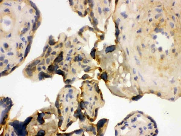 Anti-YB1/YBX1 Antibody Picoband® Boster Bio