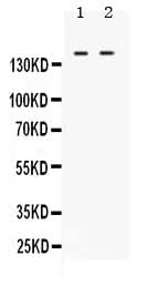 Anti-c Abl/ABL1 Antibody Picoband® Boster Bio
