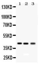 Anti-RAGE/AGER Antibody Picoband® Boster Bio