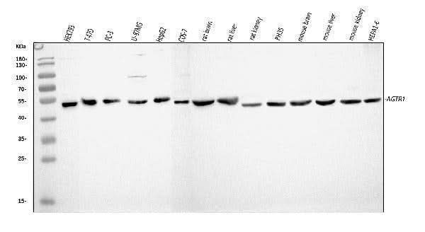 Anti-Angiotensin II Type 1 Receptor/AGTR1 Antibody Picoband® Boster Bio
