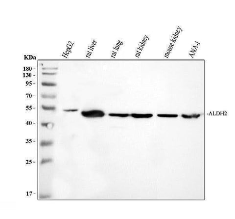 Anti-ALDH2 Antibody Picoband® Boster Bio