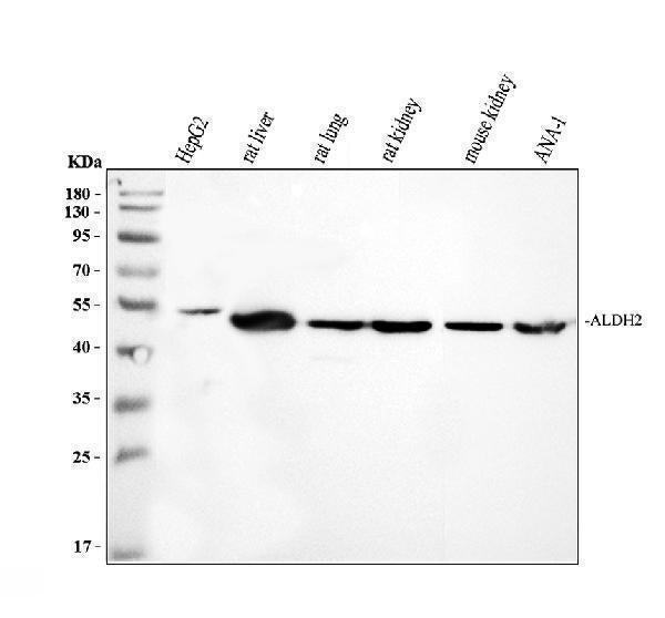 Anti-ALDH2 Antibody Picoband® Boster Bio